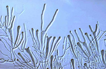 Two-spored tuning fork basidia of the jelly fungus Dacrymyces